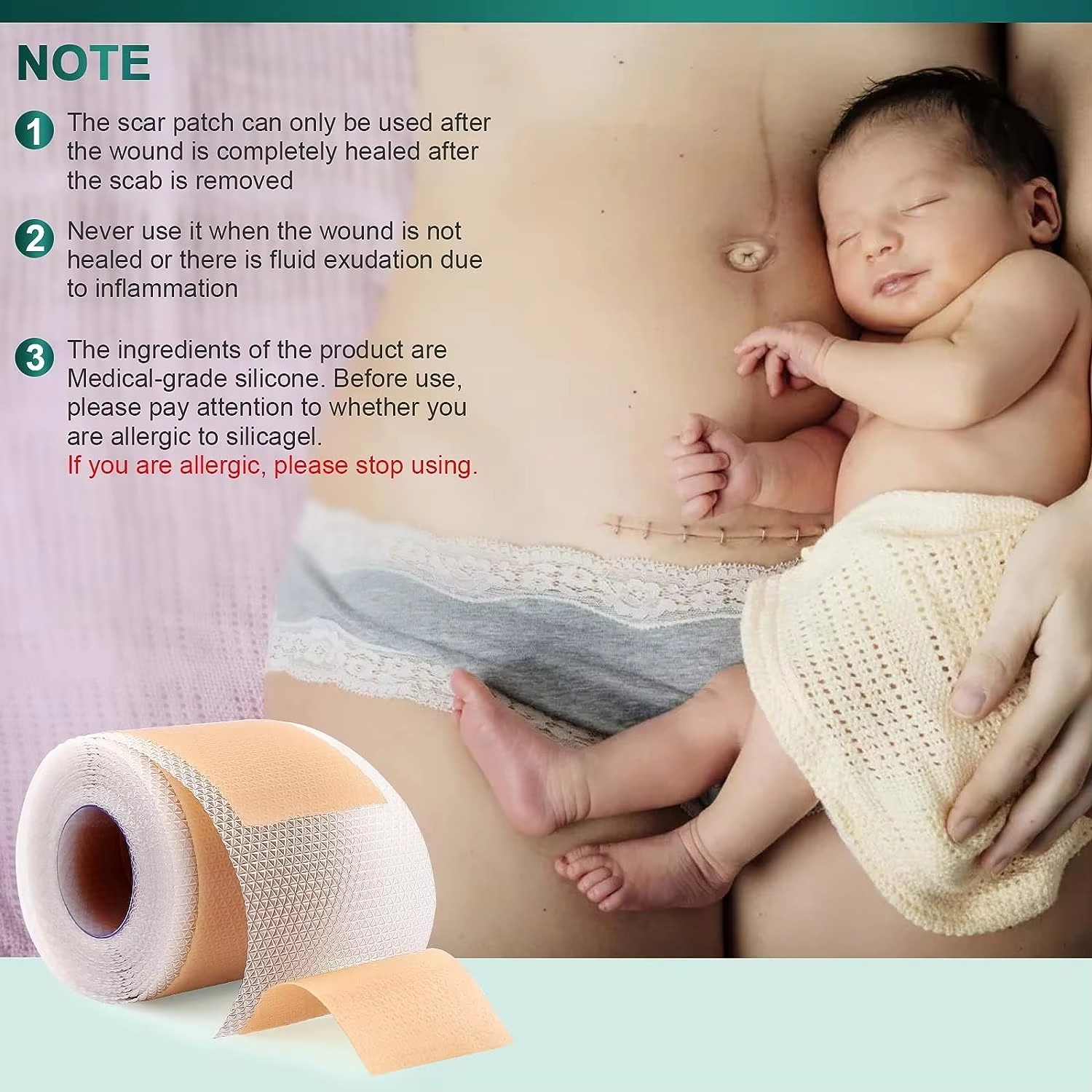50/100/150cm Silicone Gel Scar - Medical Tape review and price