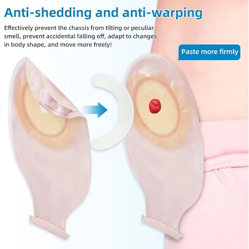 Medical Ostomy Bag Reinforceme - Medical Tape review and price